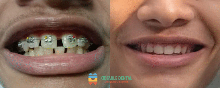 Smile Story: A Journey from Self-Conscious to Confident